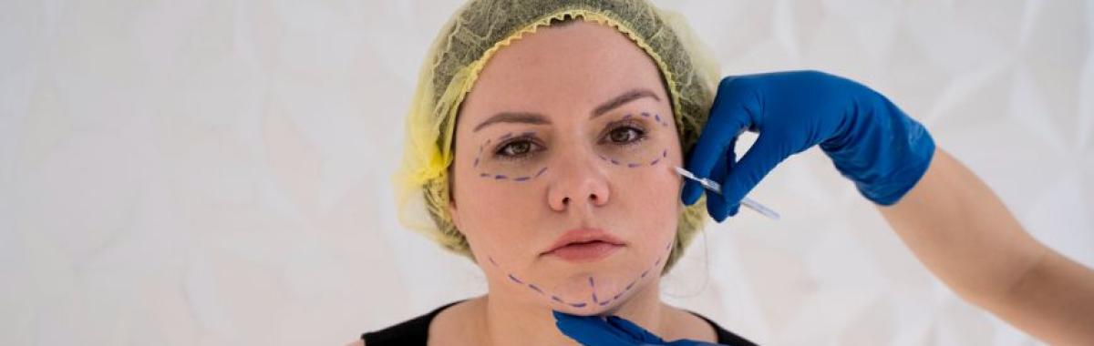 Fios De Tração Ribeirão Pires