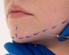 Fios De Pdo Santo André