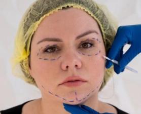 Fios De Tração Mauá