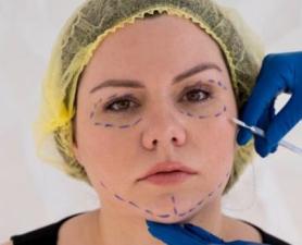 Fios De Tração Ribeirão Pires