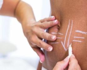 Lipo Enzimática Santo André