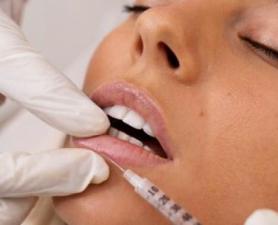 Preenchimento Labial Mauá