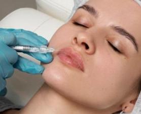 Preenchimento Labial