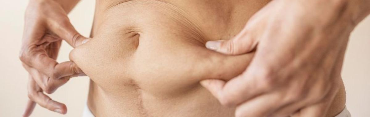 Tratamento De Flacidez Ribeirão Pires