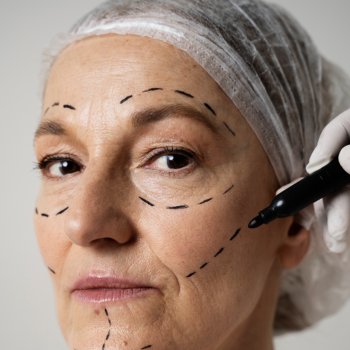 Estímulo de Colágeno