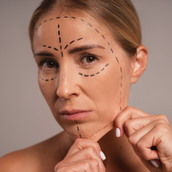 Fios de PDO – Tração